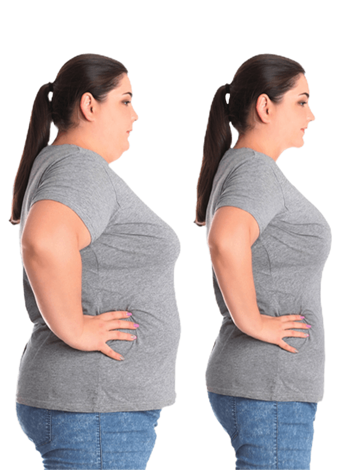 obesity treatment in chennai