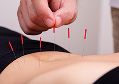 Diabetic acupuncture treatment in chennai